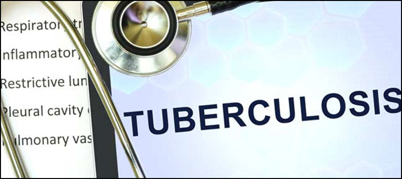 WHO recommends new test, treatment plan for superbug strains of TB