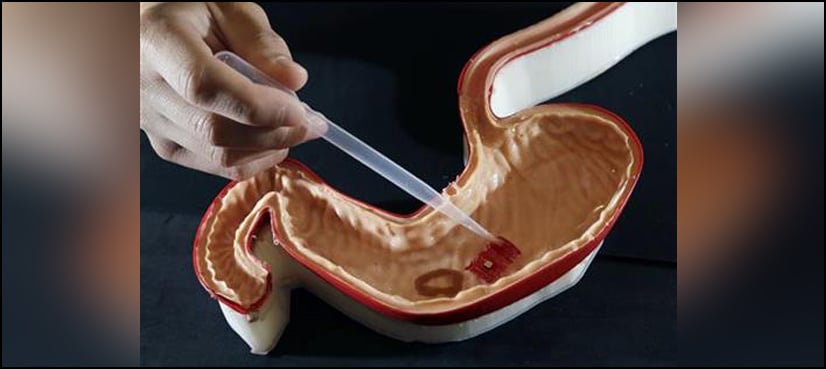 Got stomach issues? Try swallowing an origami robot