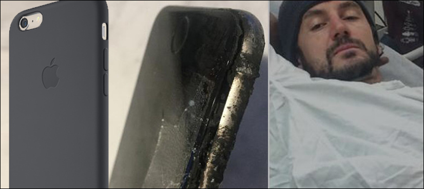 Man suffers severe burns after iPhone 6 exploded in his pocket