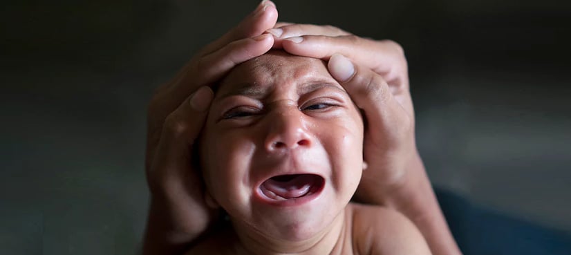 World must ready for global microcephaly 'epidemic': study