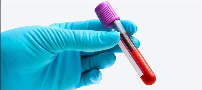US researchers develop rapid blood test for TB