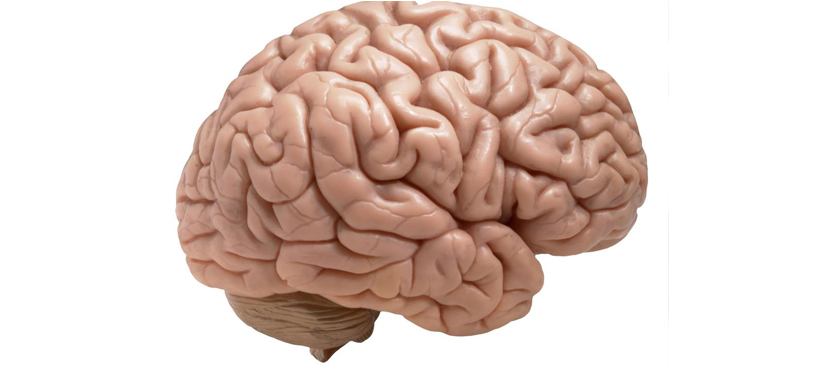 IBM to integrate MedyMatch technology to help spot brain bleeding