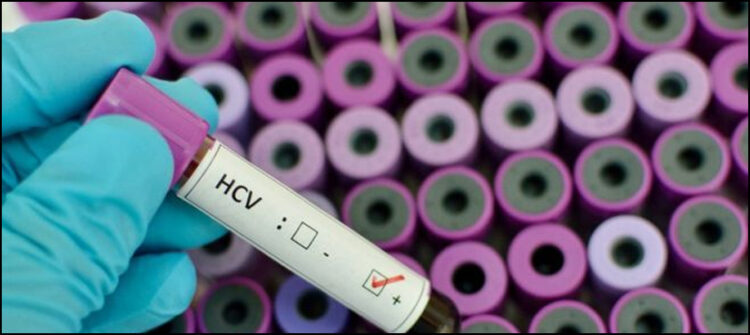 Pakistan aims to eliminate Hepatitis in 3-4 years: Ahsan Iqbal