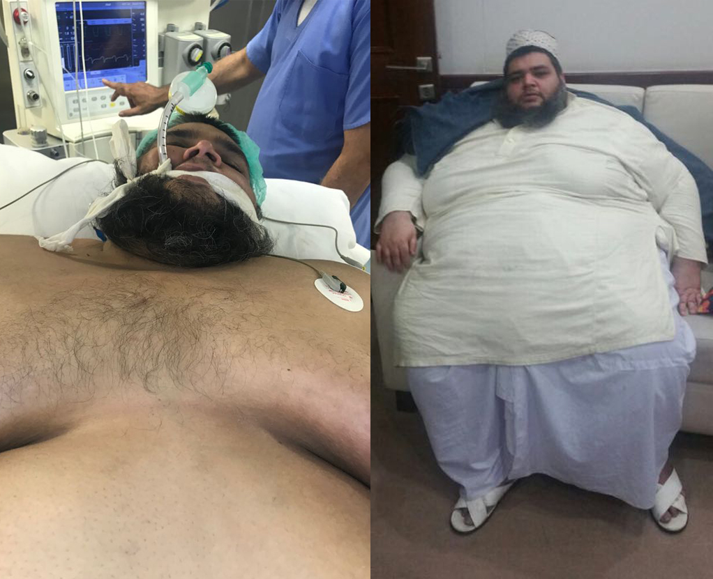 Meet Pakistan's most obese man Muhamamd Naveed