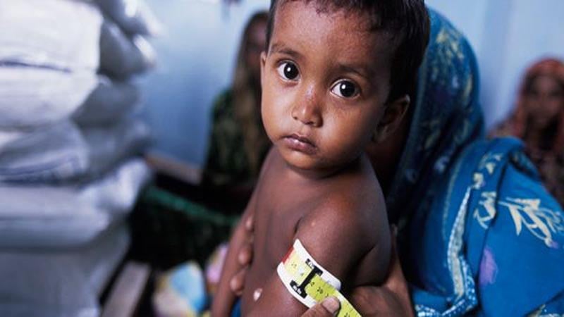 Two more infants fall prey to deadly malnutrition in Tharparkar