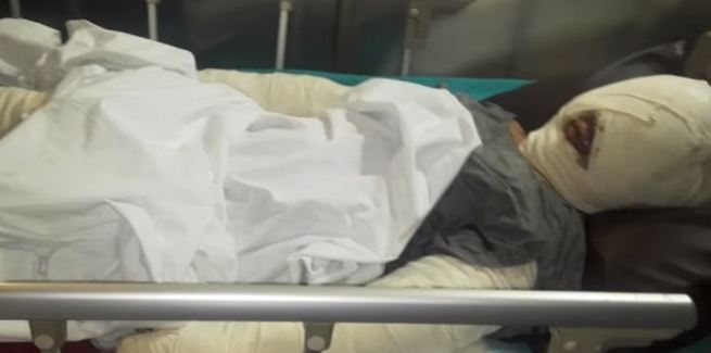 Man awarded 60 years in prison for revengeful acid attack on fiancé.