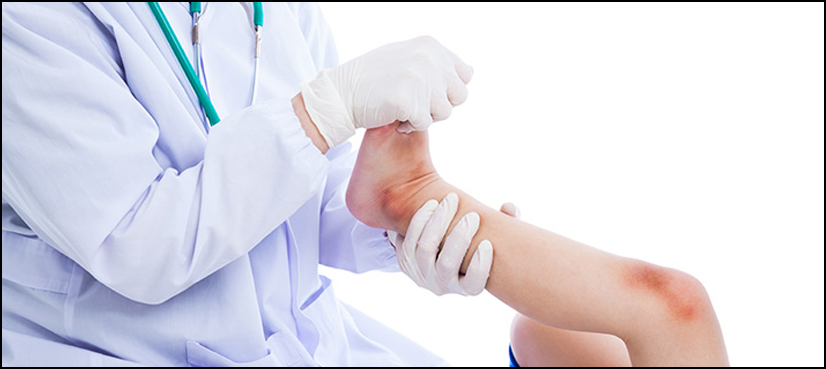 Serious knee injuries increasing in kids and teens, researchers warn