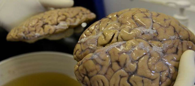 No new 'learning' brain cells after age 13: study