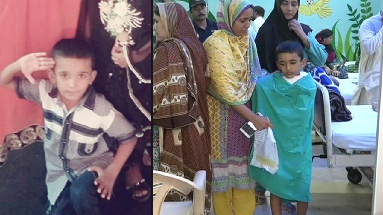 Young boy loses both hands after live wire falls on him