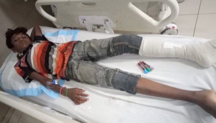 Another stray bullet incident leaves minor injured in Karachi