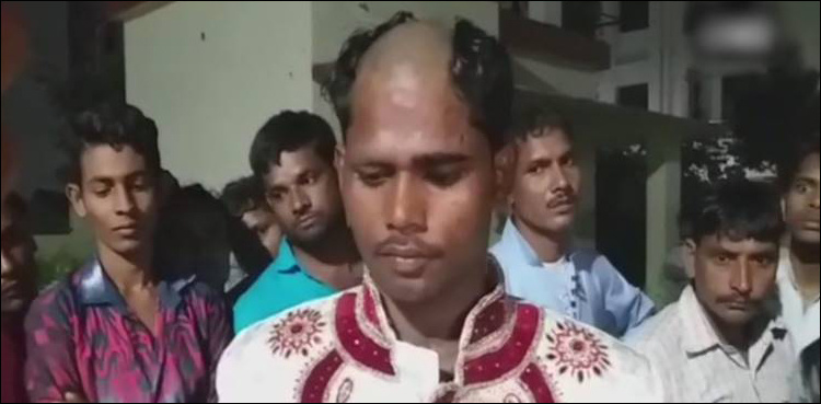 Indian groom’s head partially shaved after he demands dowry