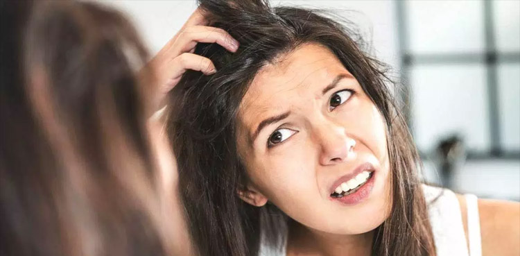 NINE Best home remedies for Dandruff OR Itchy Scalp