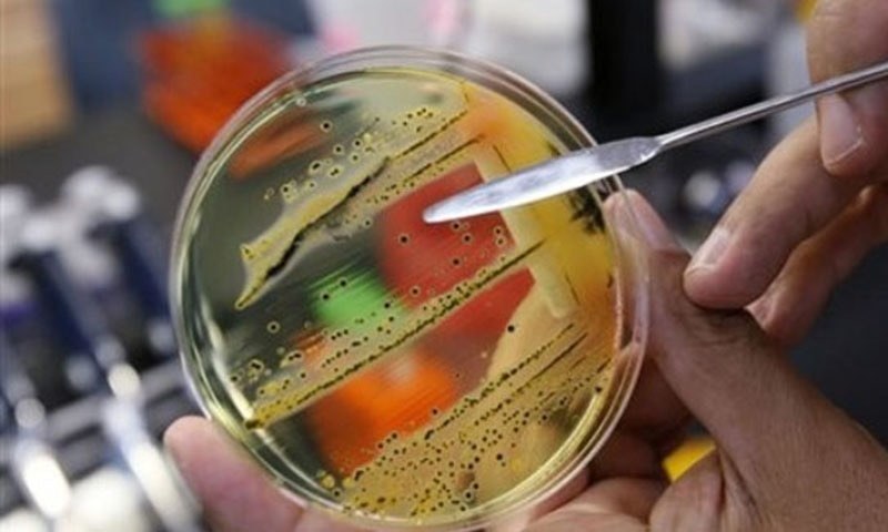 Pakistani population has high antimicrobial resistance levels: study