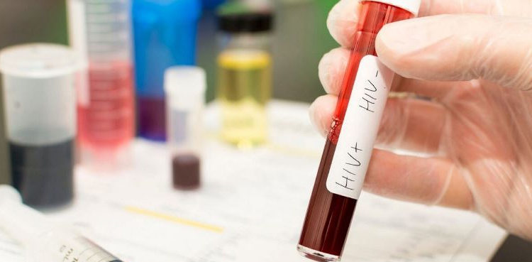 Three-day HIV screening camps established in Nawabshah