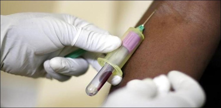 59 test positive for HIV AIDS in Larkana, Rato Dero