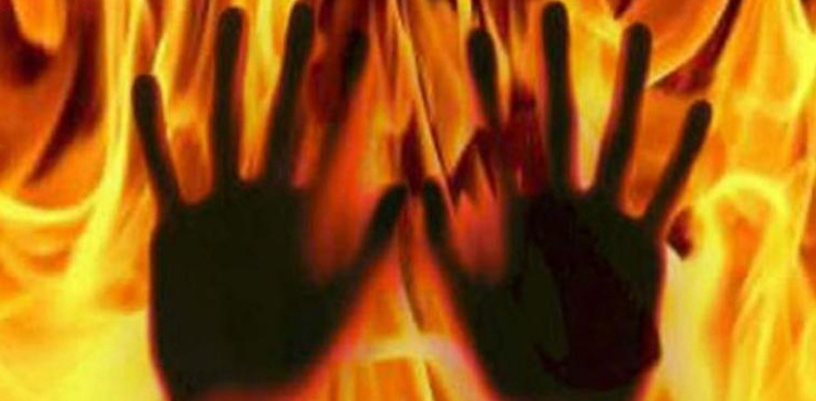 Narowal Woman burnt by in-laws dies
