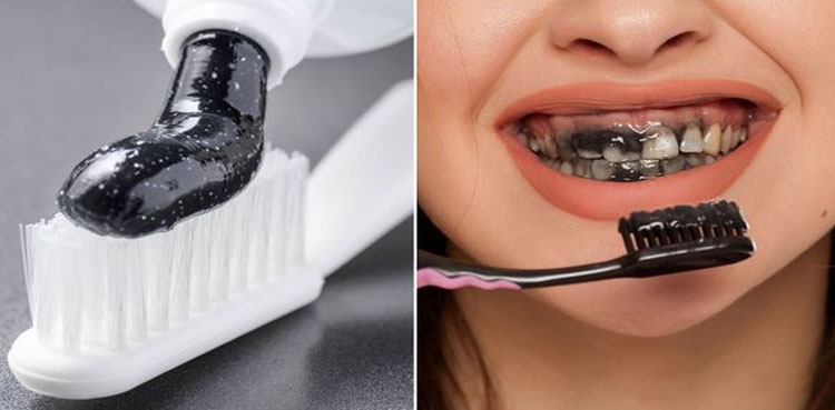 Charcoal toothpaste may do harm and not much good