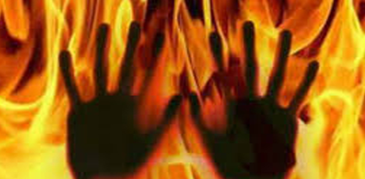 12-year-old girl set on fire in Faisalabad