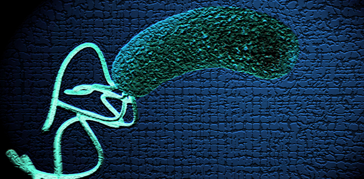 Cholera outbreaks surging worldwide: WHO