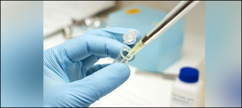 Sindh reports 67 dengue fever cases this month: health deptt