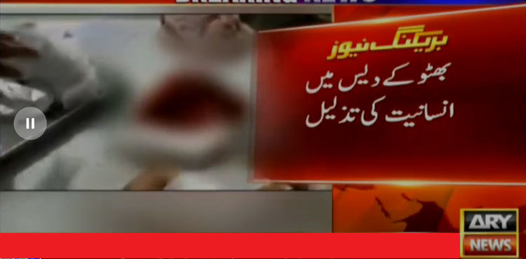 Dogs mutilate child in Larkana, doctors refuse treatment