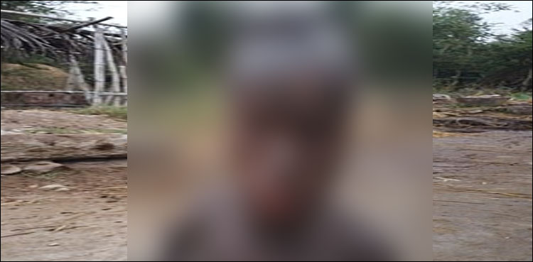 Boy being dubbed 'human snake' due to rare medical condition