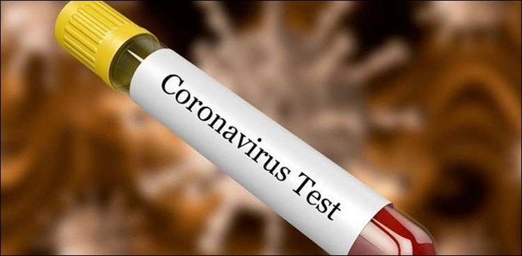 Coronavirus: Screening of 1,327 suspected patients completed in Jhelum