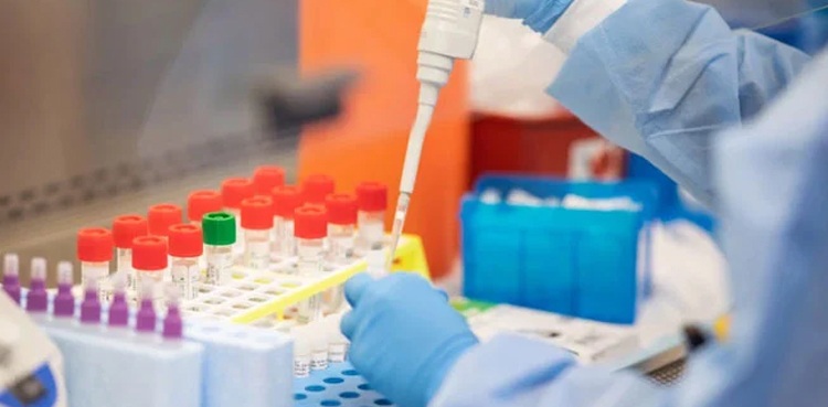 Sindh set to ramp up Covid-19 testing as 50,000 kits reach Karachi