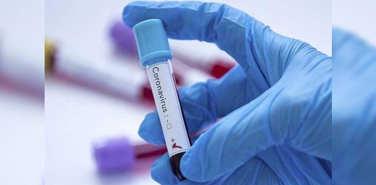 82 more COVID-19 cases surface in Gilgit-Baltistan