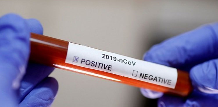 Hyderabad overtakes Karachi to record highest Covid positivity rate