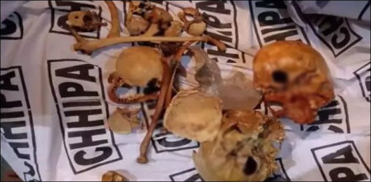 Skulls, human bones found in Karachi's Defence used for study purpose: medical report