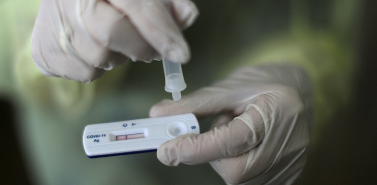 CAA takes notice of exorbitant charges for rapid PCR test from UAE travelers