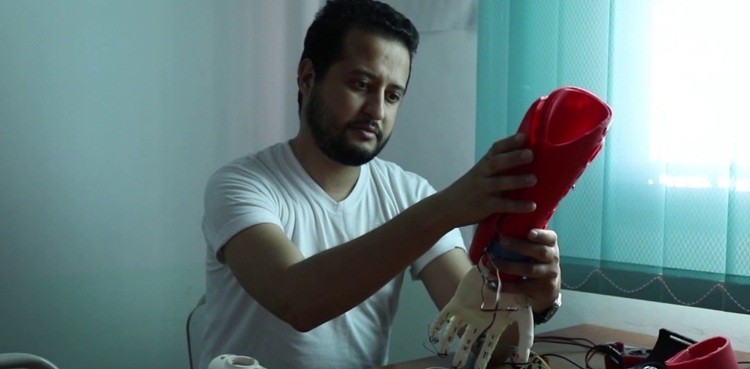 Startup 3D prints solar-powered bionic hands