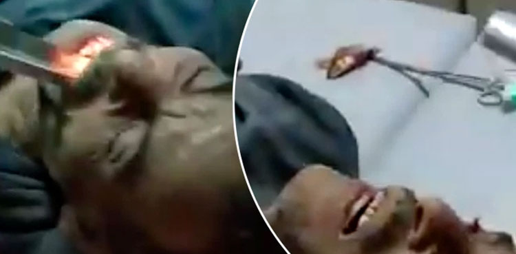 Horrific Video: Live fish gets stuck in man's throat