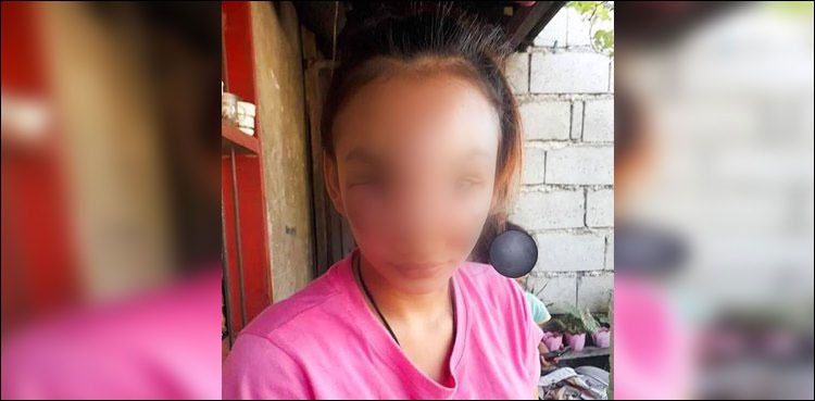 Teenager's face ravaged after squeezing a blackhead on her nose