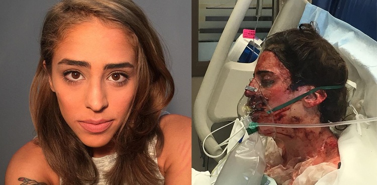 TW: Woman suffers scary skin reaction, coma after taking depression pills