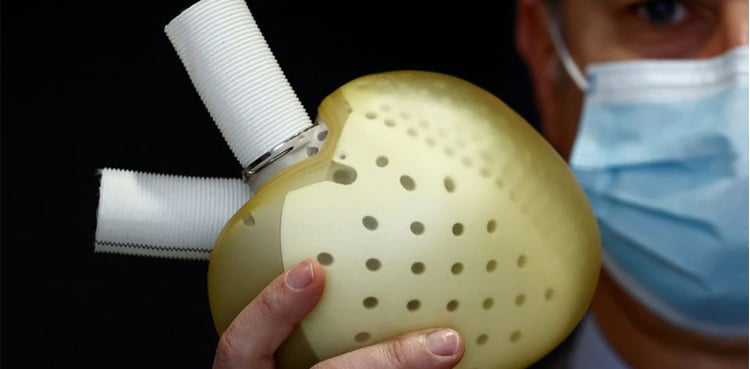 French company announces first implant of its artificial heart in a woman