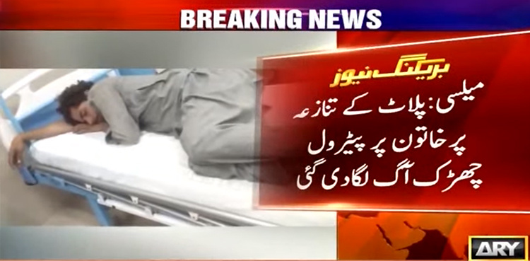 Woman set on fire over property issue, suffers burns to 80pc body