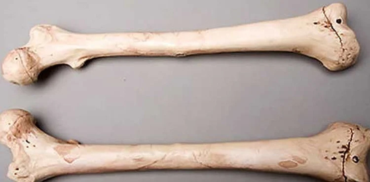 Locals find human bones packed in a sack from empty plot in Lahore