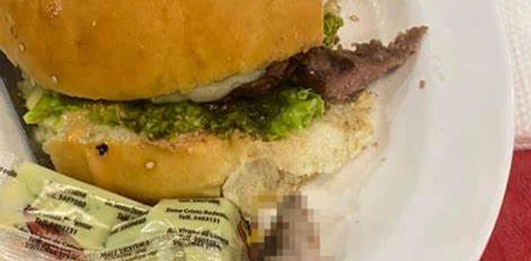 Horrific: Woman finds human finger in burger!