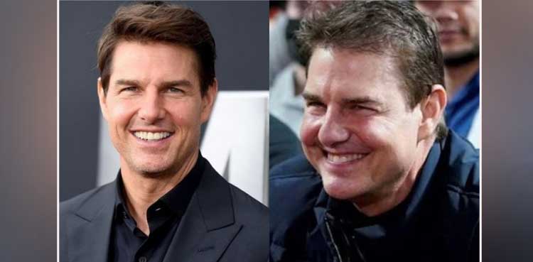 Tom Cruise undergoes facial surgery, fans unable to recognize him