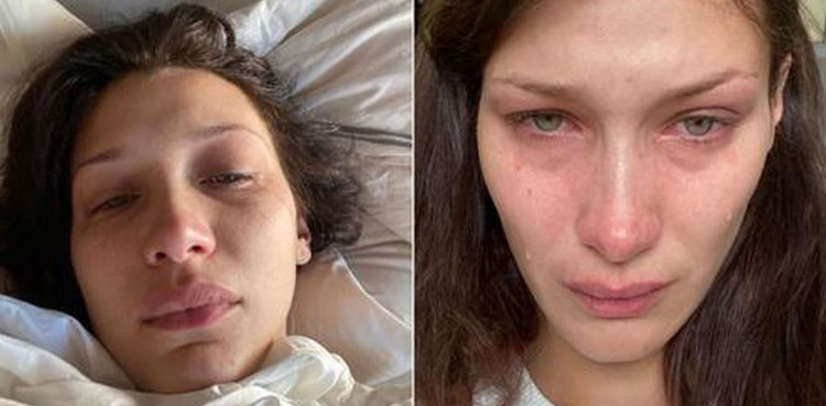 Bella Hadid thankful for emotional support, selfies go viral
