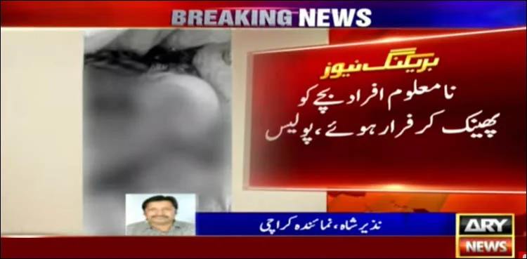 Half-burnt infant dies at Karachi’s medical facility