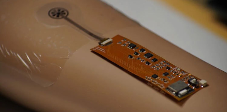 Singapore: 'Smart bandage' to enable patients to monitor wounds via app