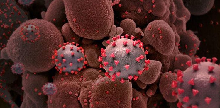 Covid positivity ratio in Karachi alarming, crosses 40 pct