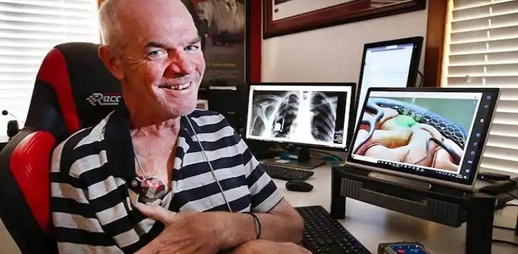 Paralysed man first to send tweet using only his brain