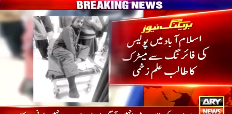 Student injured by police firing in Islamabad