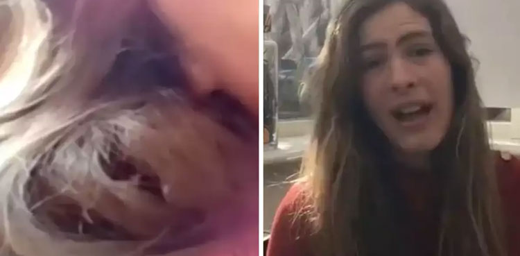 VIral: Abandoned Bird builds nest in woman's hair for 84 days