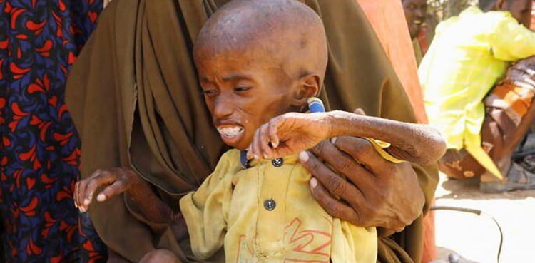 Somalia's worst drought in four decades means millions need aid