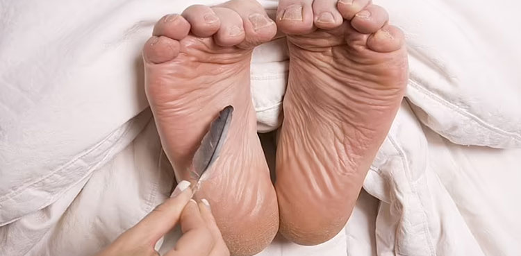 Women have more TICKLISH feet than men, study proves